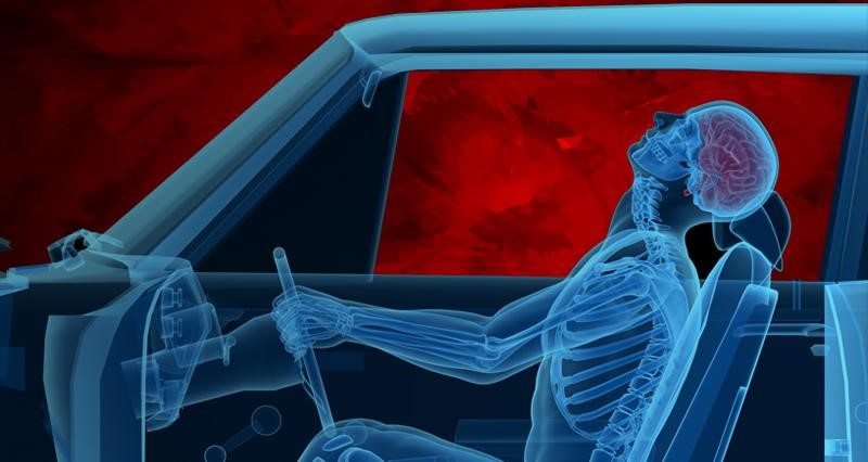 x-ray image of a body behind the steering wheel of a car on impact.